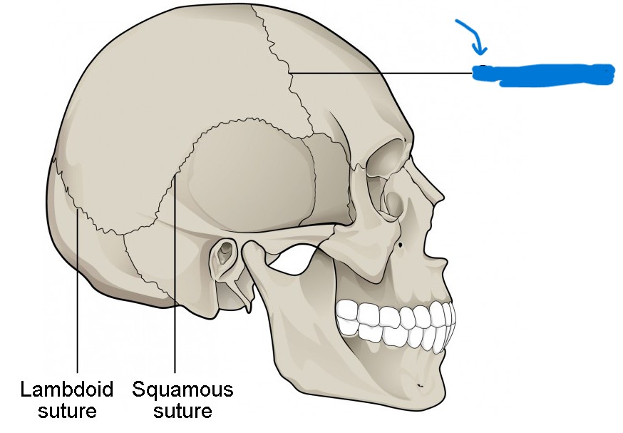 <p>What is this suture called?</p>