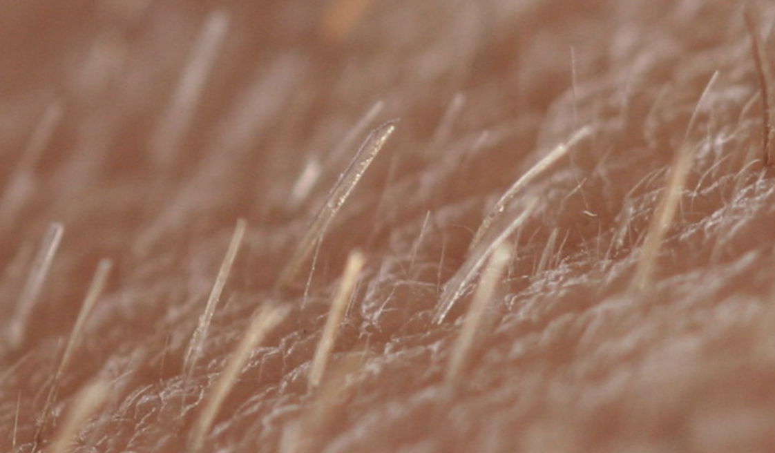 <p>known as the peach fuzz; hair that covers the majority of the body</p>
