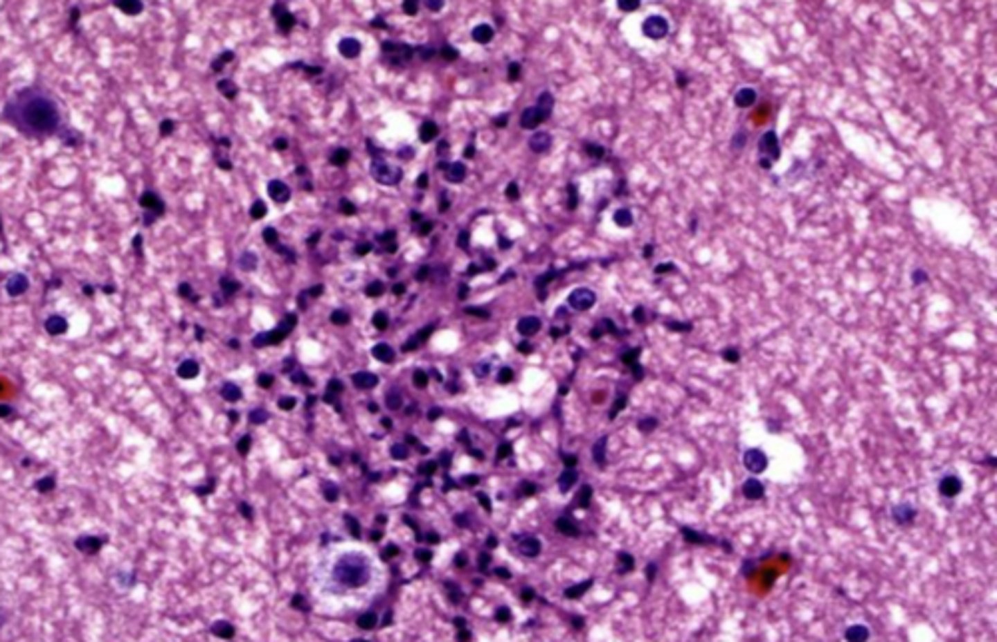 <p>how can you tell if these are oligodendrocytes or microglia?</p>