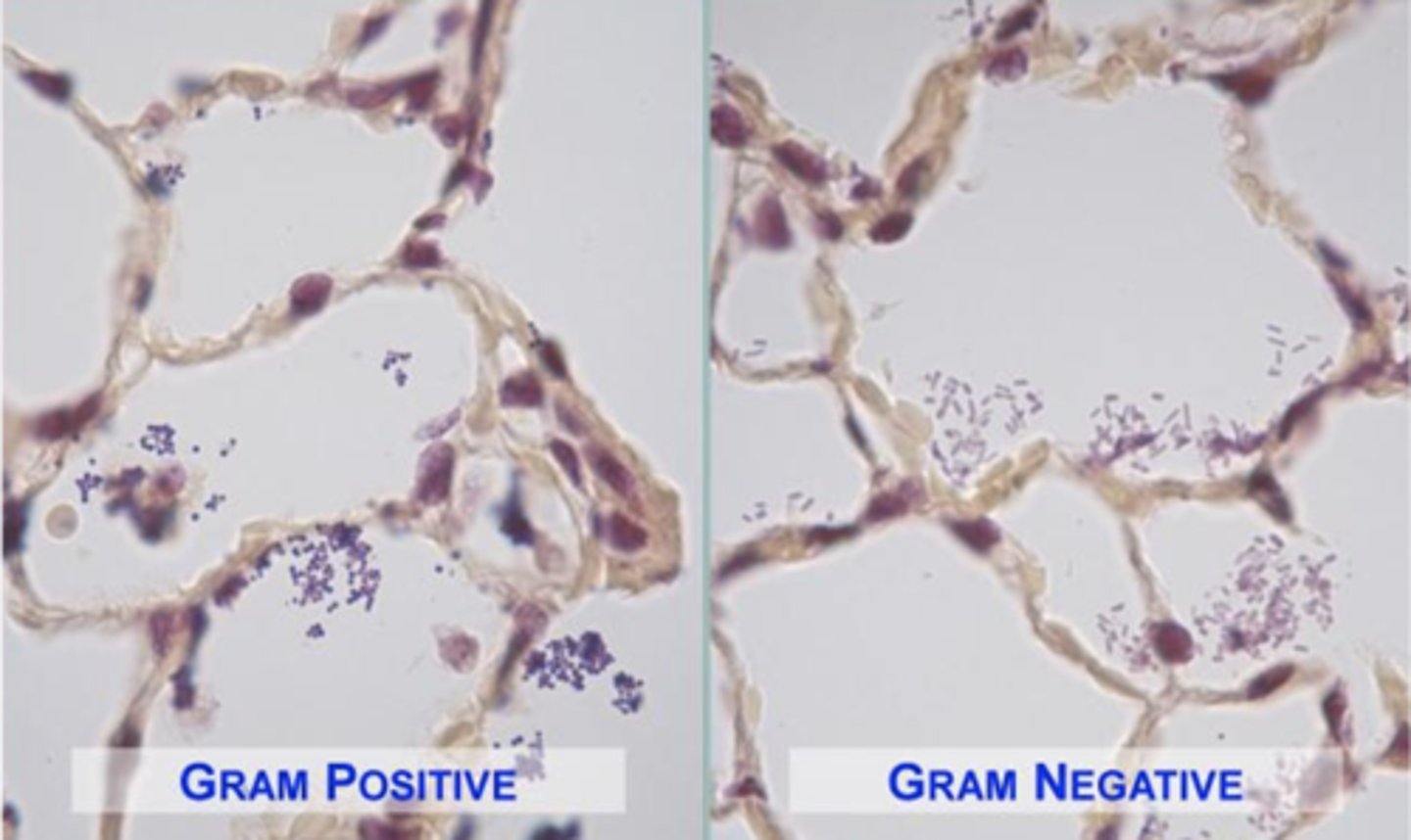 <p>Gram positive organisms purple; Gram negative organisms red to pink</p>
