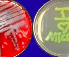 <p>Identify the pathogen?</p>