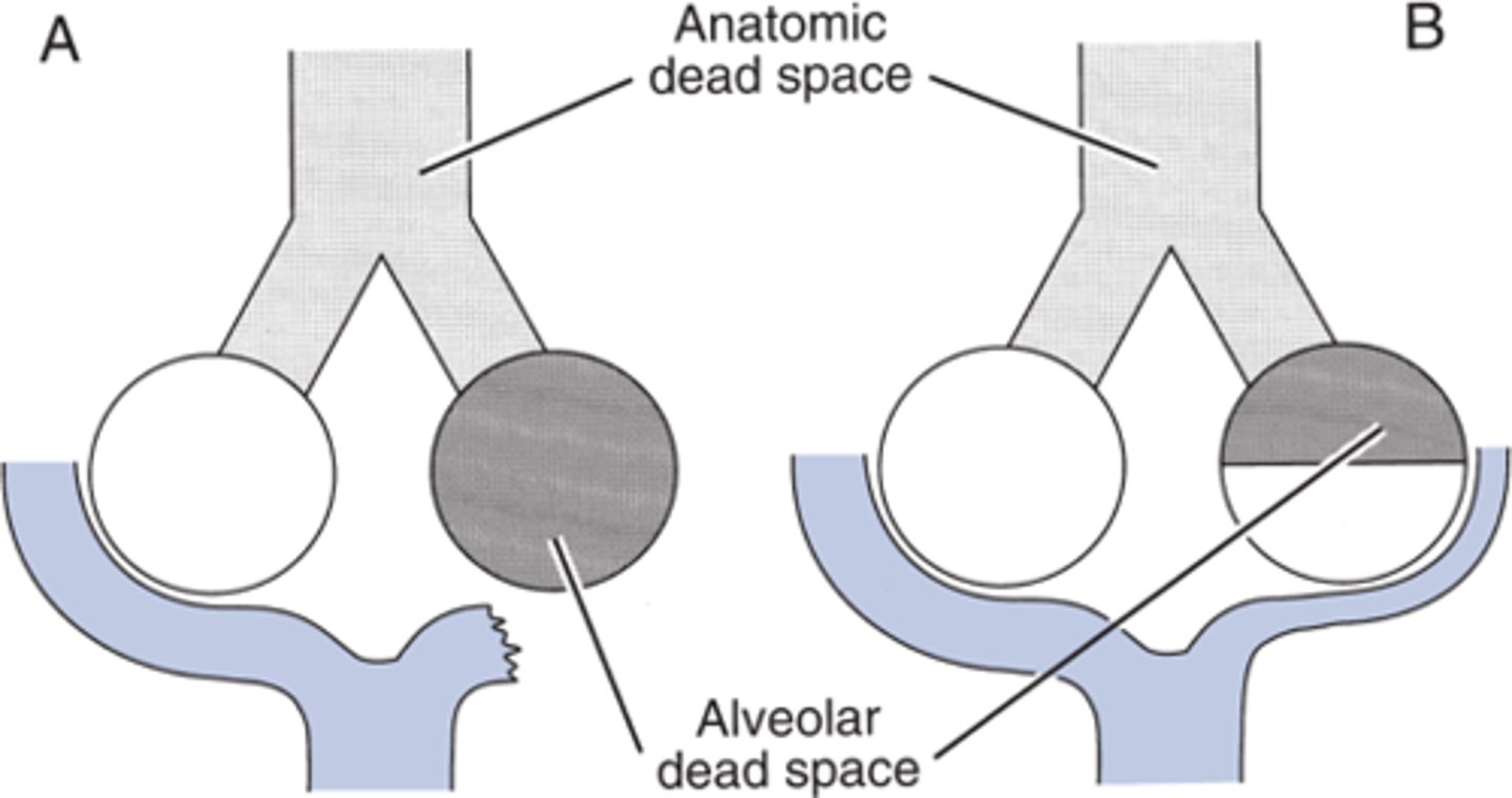 <p>Any portion of the airway that does contain air and cannot participate in gas exchange, such as the trachea and bronchi.</p>