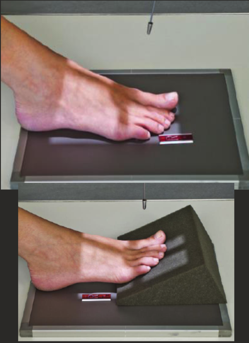 <ul><li><p>Patient lying or sitting on table.</p></li><li><p>Bent knee, sole of foot perpendicular to IR.</p></li><li><p>Foot’s long axis parallel to IR’s edge, toes UNCURLED.</p></li><li><p>CR angled 10-15 degrees posteriorly (towards calcaneus).</p></li><li><p>Centre to MTP joint.</p></li><li><p>Collimate for skin edges distally and MT base proximally.</p></li></ul><p></p>