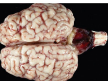 <p>Cerebellar hypoplasia</p>