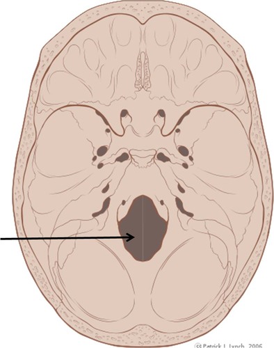 term image