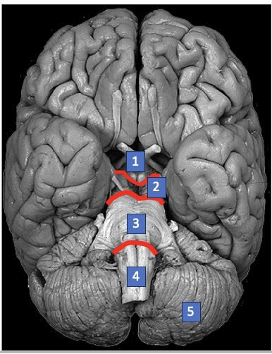 <p>What structure is labeled 5?</p>