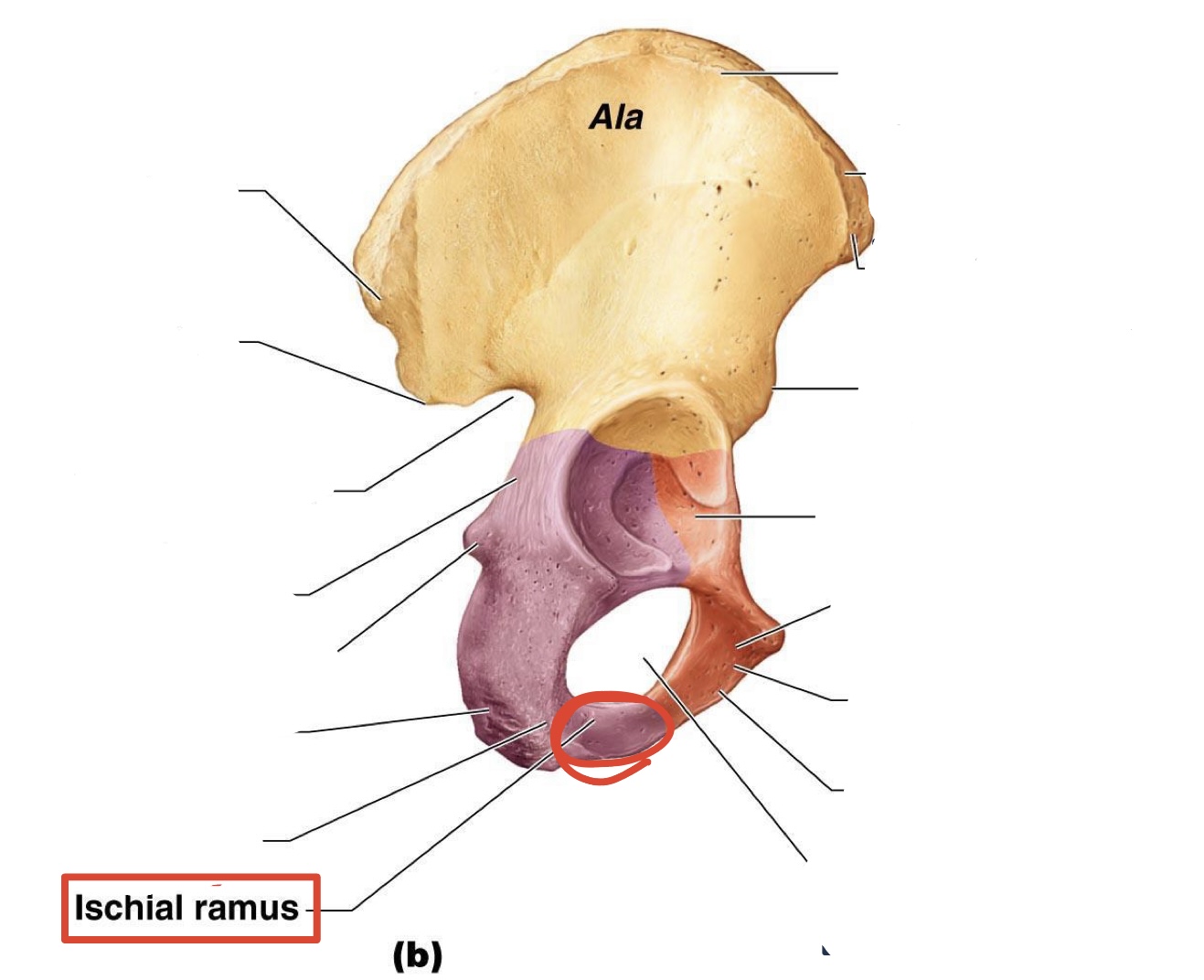 <p><span><span>Ischial ramus</span></span></p>