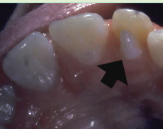 <p>what is shown here?</p>
