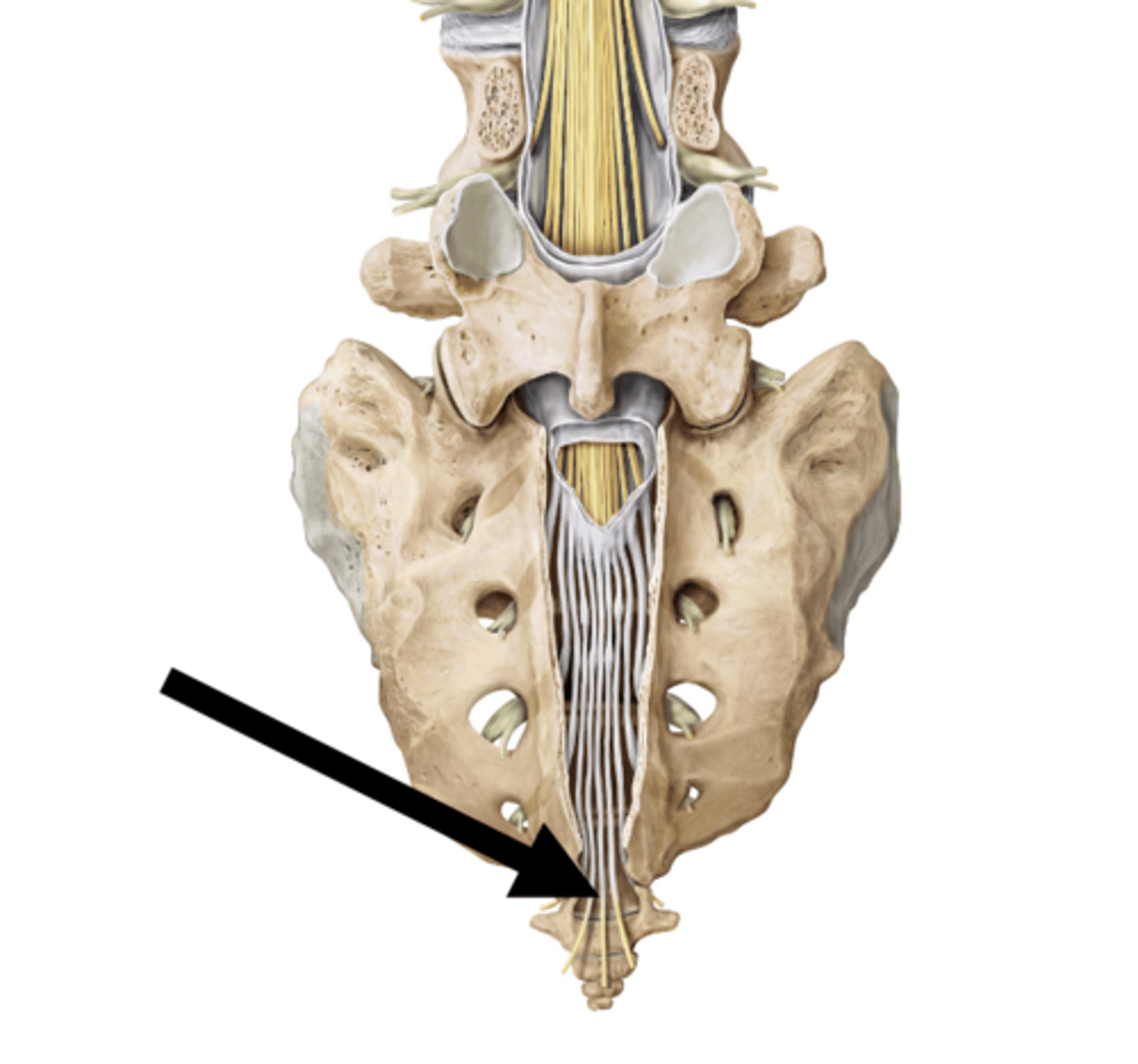 <p>fused extension of the dura and pia maters; passes through sacral hiatus to coccyx; "coccygeal ligament"</p>