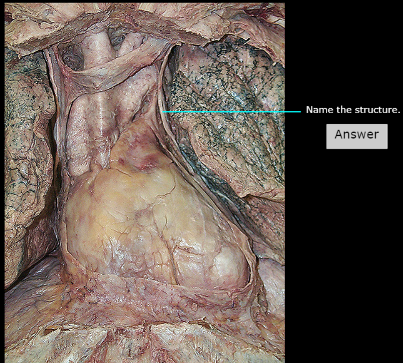 <p>What nerve is this</p>