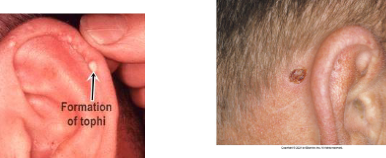 <p>Ears </p>