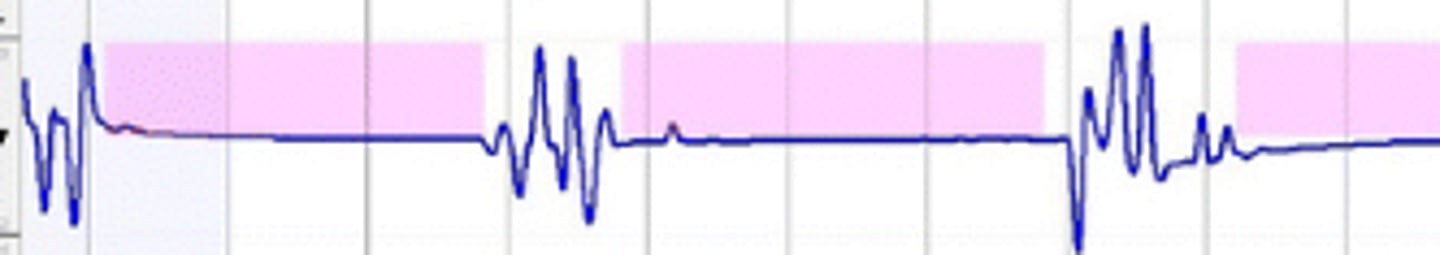 <p>breathing stops for a brief period; this happens to many in their sleep</p>