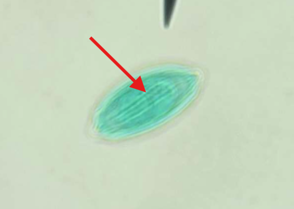 <p>What are the folds on the Ephedra Pollen Grain called?</p>