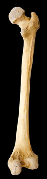 <p>Name this bone.</p><p>(Posterior view, right side).</p>