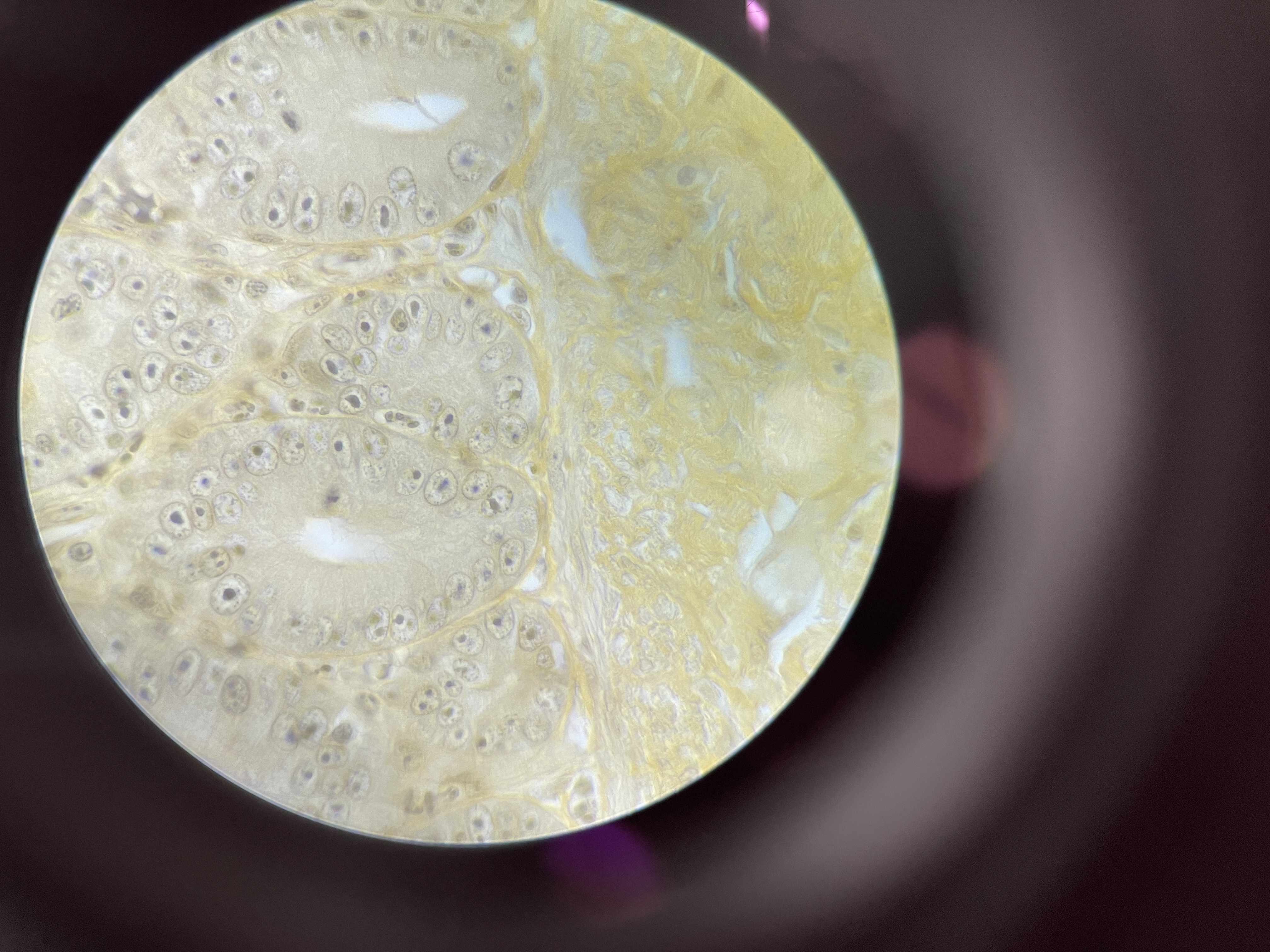 <ul><li><p>causes toxoplasmosis </p></li><li><p>asymptomatic until it attacks a major organ </p></li><li><p>50% people in developing countries with toxoplasmosis</p></li><li><p>crazy cat person syndrome </p></li><li><p>intracellular protists</p></li></ul>