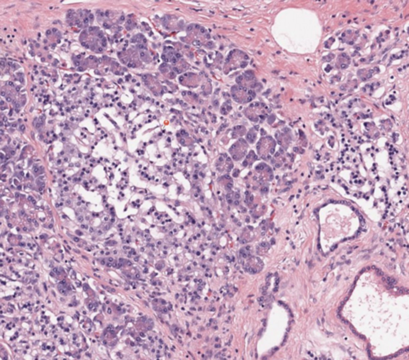 <p>Pancreas</p>