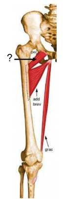 <p>Nom et caractéristiques de cette structure ?</p>