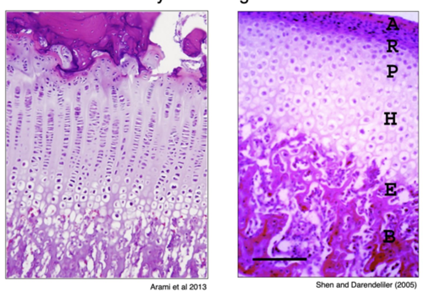 <p>The potential for different patterns of mandibular rotation is evident in the</p>