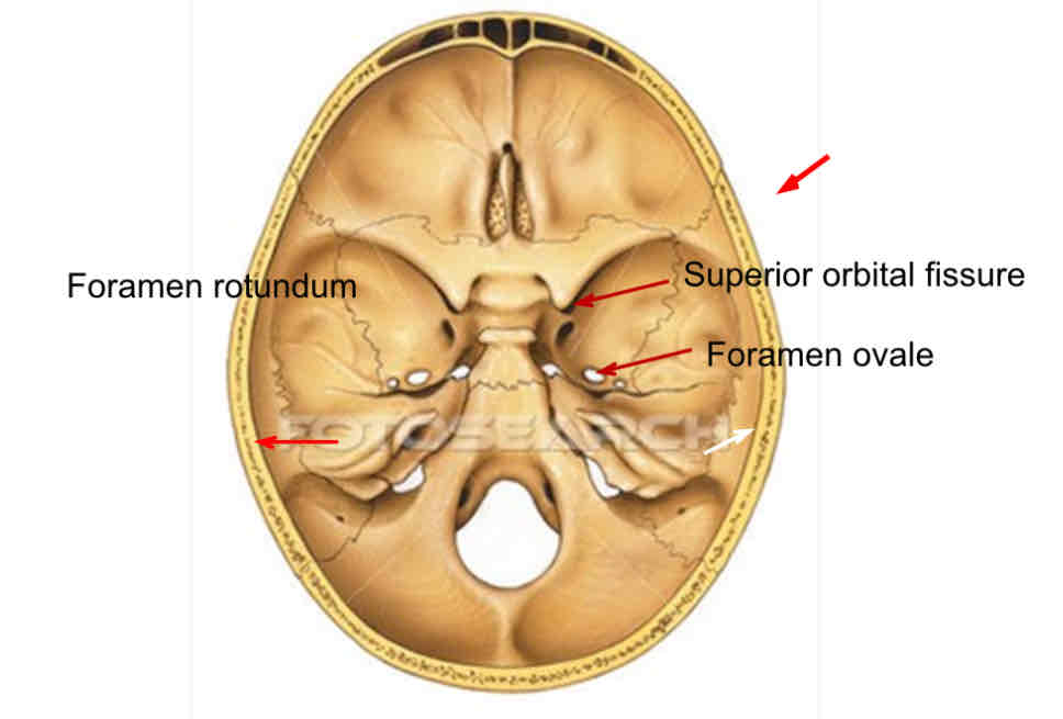 <p>What cranial nerve is indicated? </p>