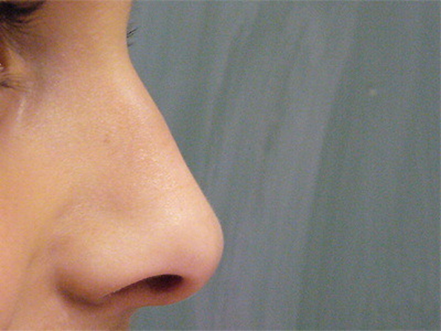 <p>DEFINITION</p><p>nose</p>