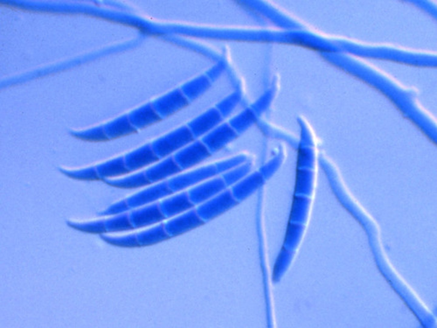 <p>Rapid</p><p>White, wooly, turns lavender with age</p><p>Reverse: colorless</p><p>Microscopic: macrophialoconidia banana shaped</p><p>Conditions: keratomycosis (most common cause)</p>