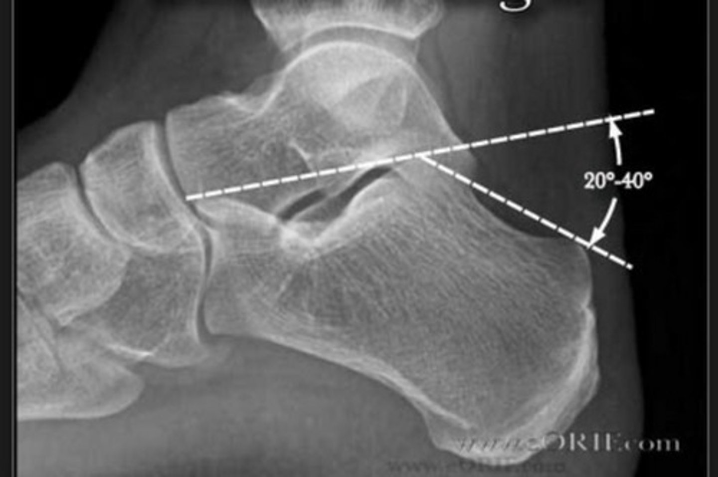 <p>What angle is this?</p>