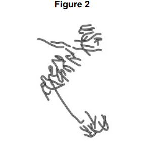 <p>A scientist treated growing tips of onion roots with a chemical that stops roots growing. </p><p>After 24 hours, he prepared a stained squash of these root tips. </p><p><strong>Figure 2</strong> is a drawing showing the chromosomes in a single cell observed in the squash of one of these root tips in anaphase. This cell was typical of other cells in anaphase in these root tips.</p><p>Use all of this information to suggest how the chemical stops the growth of roots. (3) </p>