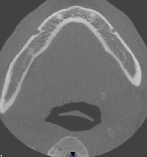 <p>at what level is this </p>