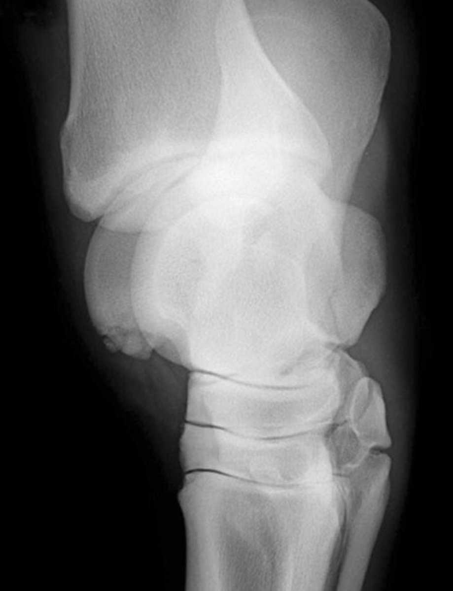 <p>What is abnormal in the radiograph?</p>