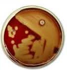 Beta hemolysis