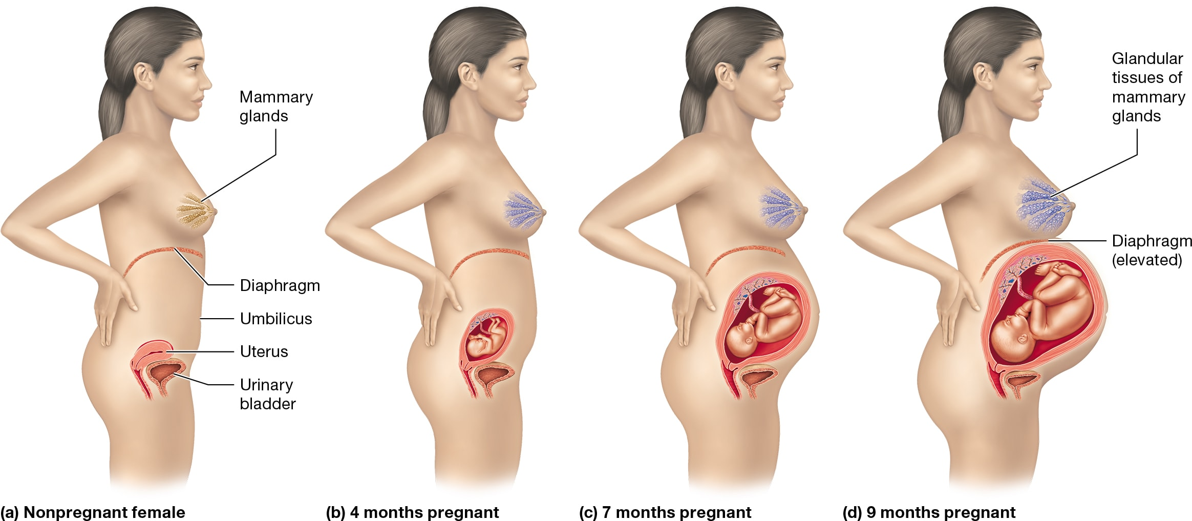 <p>Pregnancy involves numerous physiological changes across various organ systems to support the developing fetus and prepare the mother's body for childbirth and lactation.</p><ul><li><p><strong>Hormonal Changes:</strong> Hormones like aldosterone increase blood volume, while parathyroid hormone maintains high calcium levels for fetal development. Prolactin stimulates milk production, and oxytocin aids uterine contractions and milk release.</p></li><li><p><strong>Reproductive System:</strong> The uterus enlarges significantly, extending from the pelvic cavity to the xiphoid process. This growth is due to myometrium hypertrophy, placental growth, and amniotic fluid accumulation.</p></li><li><p><strong>Digestive System:</strong> Elevated hormones can cause morning sickness and constipation due to slowed peristalsis.</p></li><li><p><strong>Urinary System:</strong> Increased metabolic waste from the fetus raises the glomerular filtration rate, leading to frequent urination.</p></li><li><p><strong>Integumentary System:</strong> Changes include increased pigmentation and stretch marks due to rapid uterine enlargement.</p></li><li><p><strong>Cardiovascular System:</strong> Blood volume and cardiac output rise to support the placenta, potentially causing varicose veins and edema.</p></li></ul><p></p>