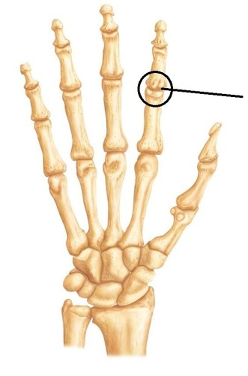 <p>What joint is this?</p>
