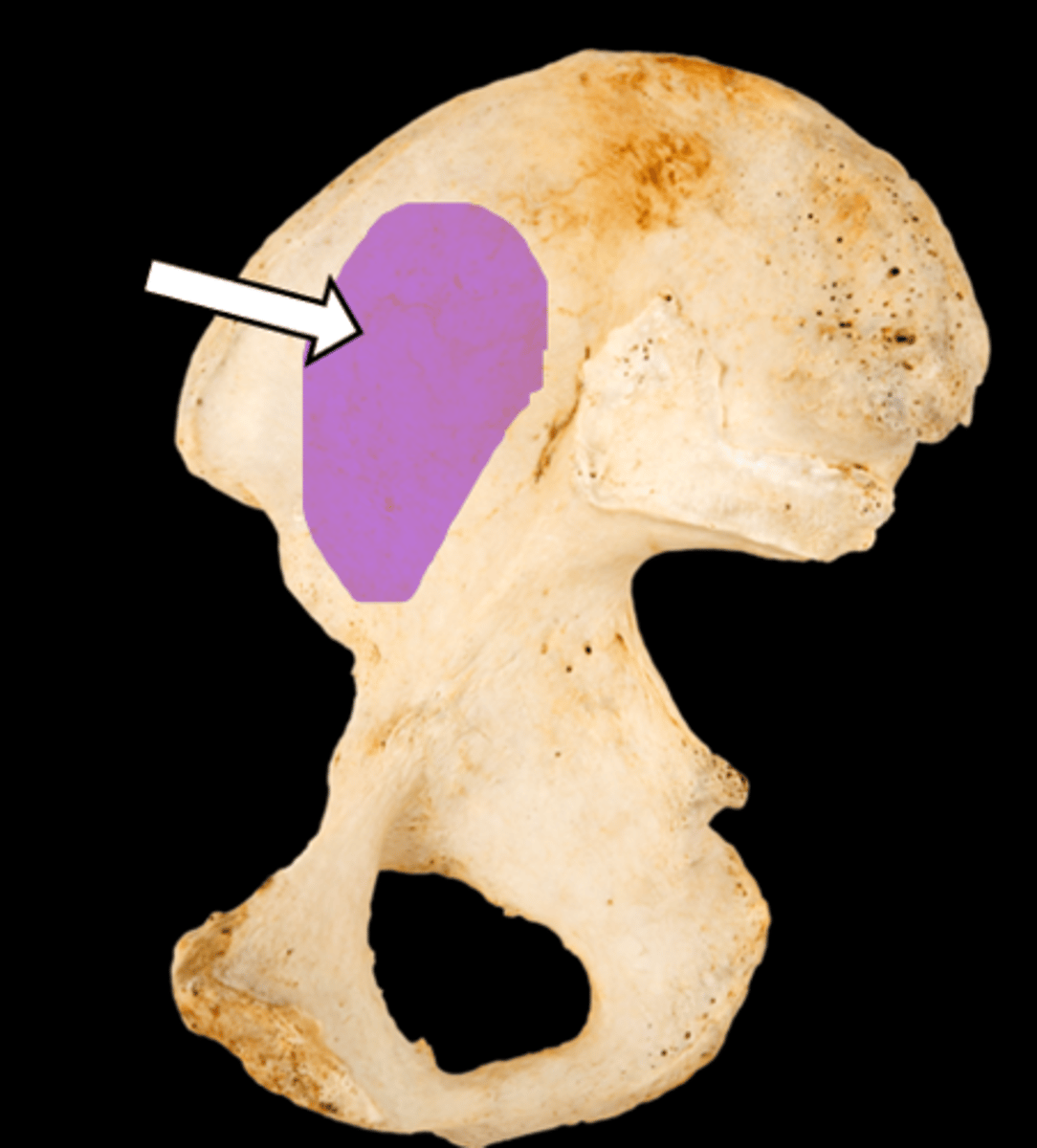 <p>name the part</p>