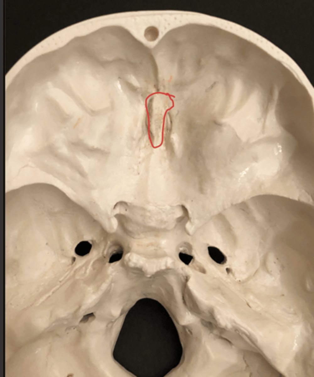 <p>Protrusion</p>