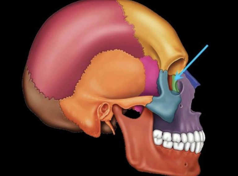 term image