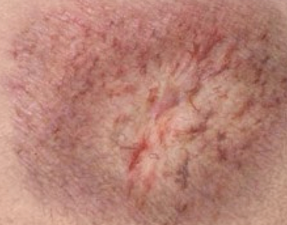 <p>what condition is depicted</p>