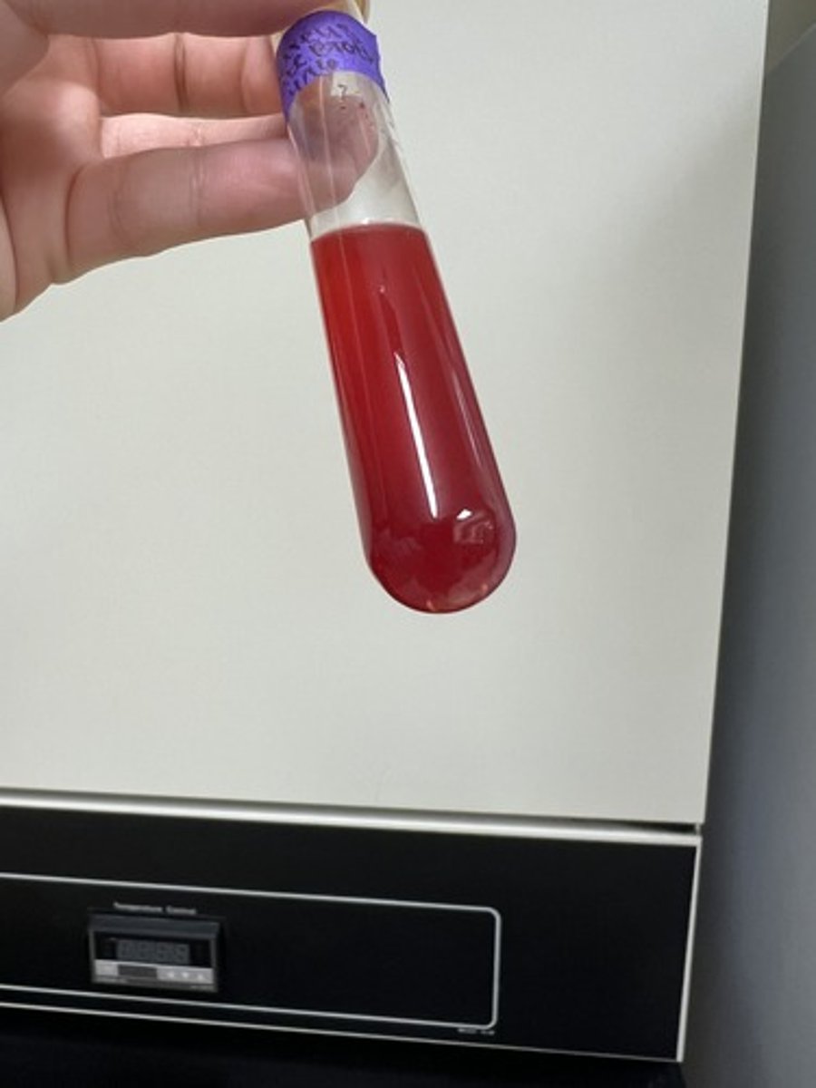 <p>Organism is able to reduce Nitrate to Nitrite.</p>