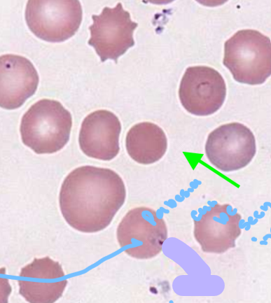 <p>ring-like organsims seen BOTH<strong> intracellularly and extracellularly </strong></p>