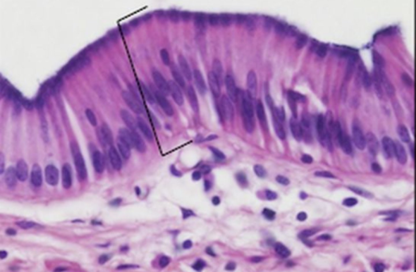 <p>Occurs mainly in male urethra and epididymis</p>