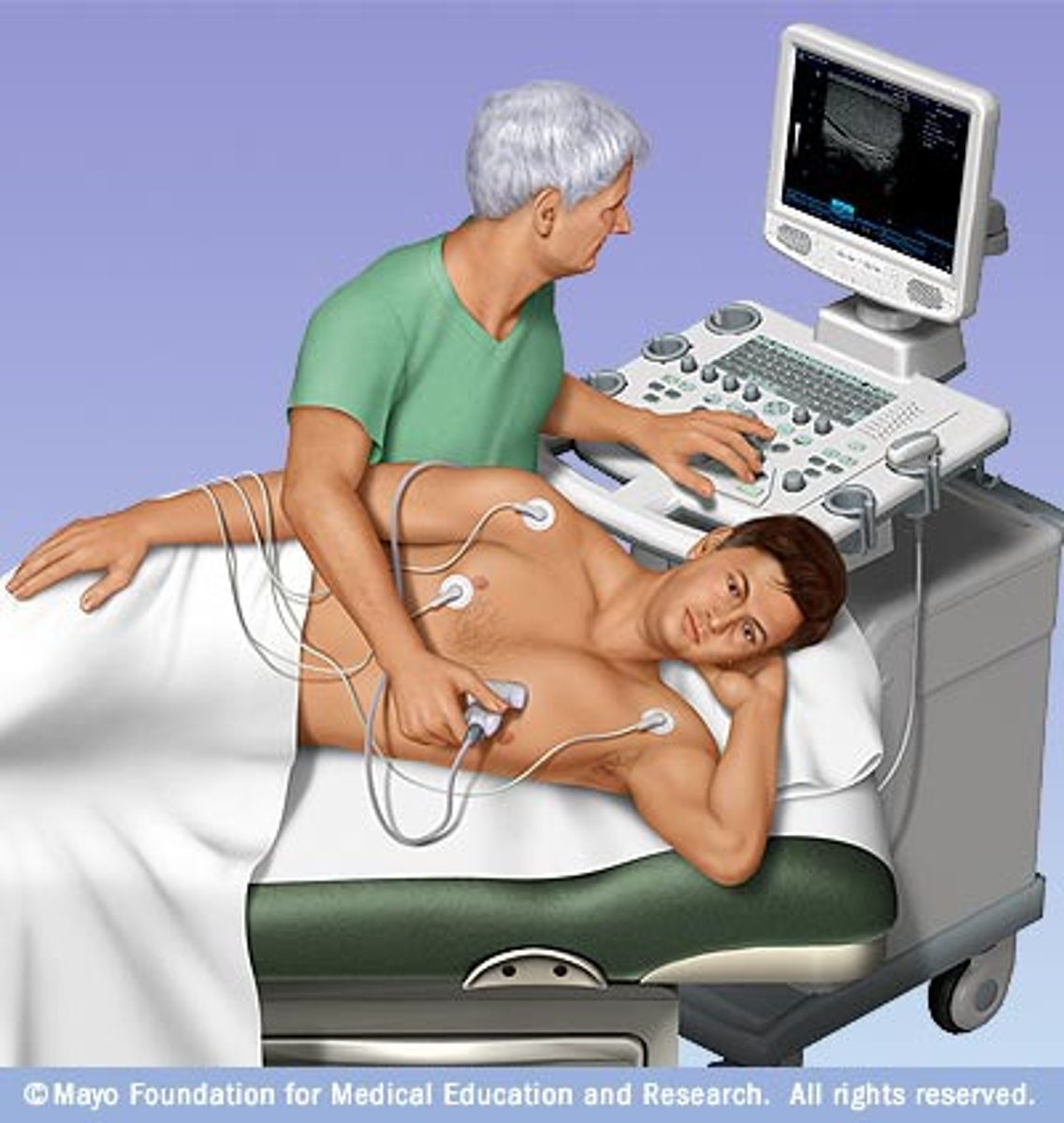 <p>ultrasound test that produces moving images of blood passing through the heart, valves, and chambers, and asses cardiac output; place transducer on chest to direct ultrahigh frequency sound waves towards cardiac structures</p>