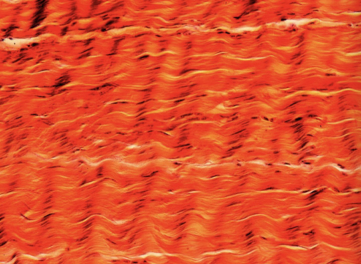 <p>What body structure could contain the tissue in the image?</p>