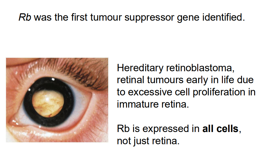 <p>Rb was the furst tumour suppressor gene identified (NO LEARNING OUTCOEM)</p>