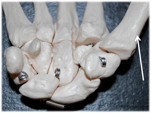 Name this specific bone of the hand (anterior view).