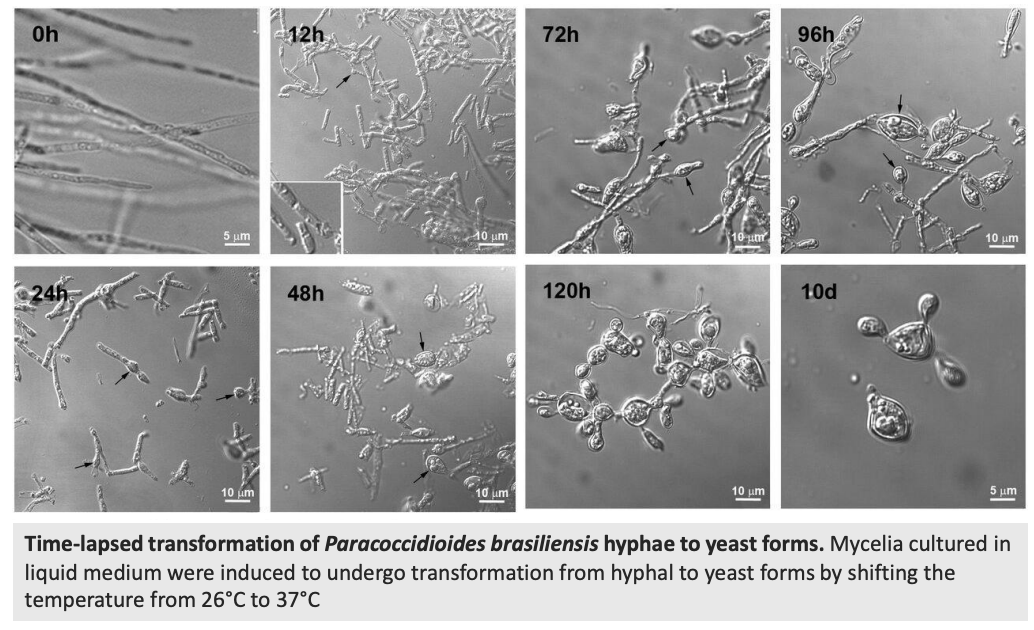 <p>Apart from <em>Paracoccidioides brasiliensis</em>, what other species can exhibit mycelium to yeast conversion? Also, <u>describe figure shown</u></p>