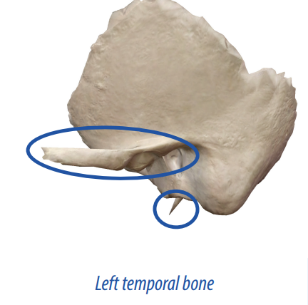 <p>An area that projects above the surface of the bone.</p>