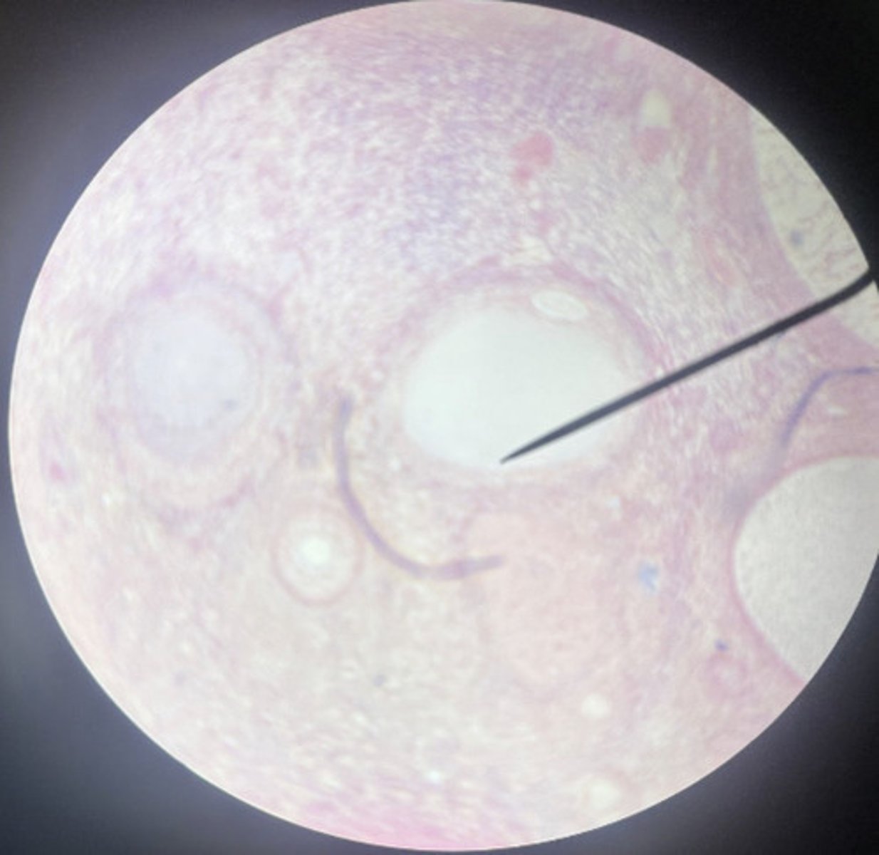 <p>what hormone does this gland secrete?</p>