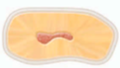 <p><span>a </span><span style="color: red;"><span>very short, complete</span></span><span> isthmus between two canals</span></p>