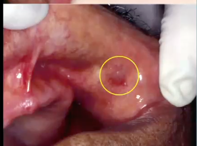 <p>diagnosis?</p>