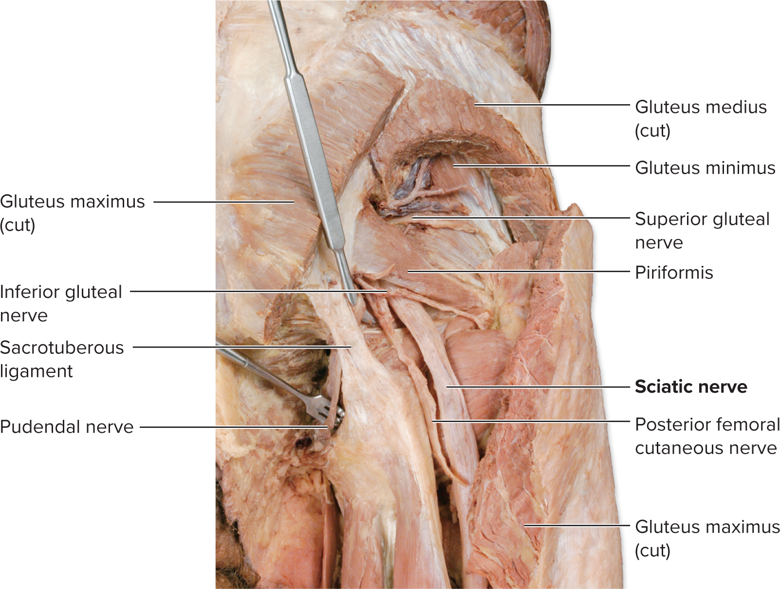 <p>Sacral Plexus (L4–S4)</p>