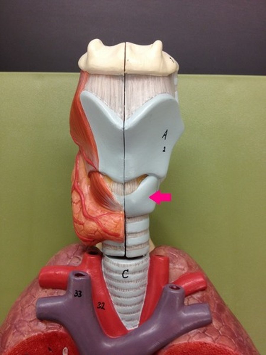 <p>Identify the structure.</p>